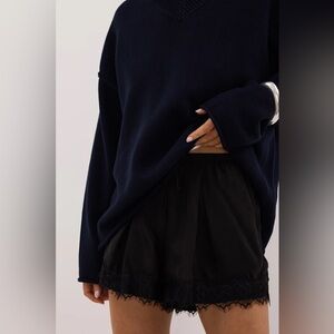 DISSH Black Lace Shorts